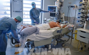 Giải mã mối liên quan tiềm ẩn giữa Covid-19 và bệnh Alzheimer