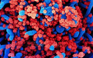 Những người mắc Covid-19 có nguy cơ cao hình thành cục máu đông trong phổi