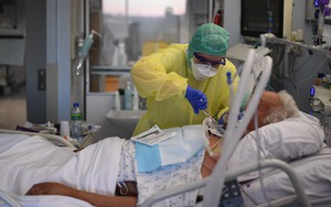 Người mắc Covid-19 thể nặng bị mất tới 10 điểm IQ