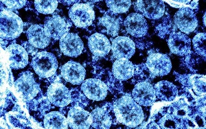 AI dự báo tiến hóa của virus SARS-CoV-2