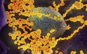 Mối liên hệ giữa nhóm máu và nguy cơ bệnh nặng khi mắc Covid-19