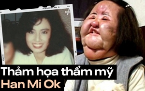 'Thảm họa thẩm mỹ' xứ Hàn: Nữ ca sĩ 17 lần phẫu thuật cứu vãn nhan sắc vì tự tiêm dầu ăn và cái chết bí ẩn tuổi 57