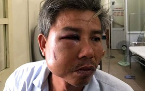 Khởi tố đối tượng gây thương tích nhân viên Trung tâm công viên cây xanh