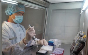 Phê duyệt kế hoạch xét nghiệm SARS-CoV-2 trong giai đoạn dịch COVID-19