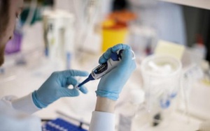 Các nhà nghiên cứu Israel tìm ra cơ chế sửa chữa ADN hiệu quả