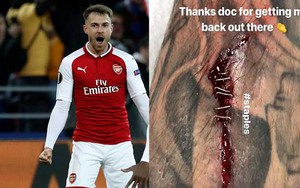 Aaron Ramsey phải vá chân bằng... ghim khi ghi bàn trước CSKA Moskva