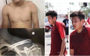 Choáng với chấn thương của ngôi sao số 1 của Trung Quốc