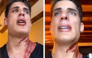 Bạn trai 'phi công' của mẹ Neymar bị đâm khi đi nghỉ ở Mexico