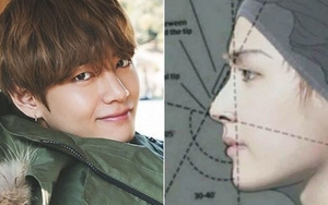 Chuyên gia thẩm mỹ hàng đầu khen ngợi gương mặt của V BTS