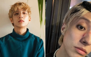 Nam ca sĩ K-pop công khai đồng tính bị hành hung