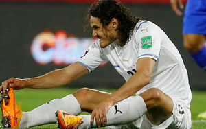 MU nhận tin xấu về Edinson Cavani