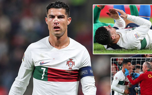 Ronaldo chấn thương, mũi bê bết máu những vẫn 'chiến' hết mình cùng Bồ Đào Nha
