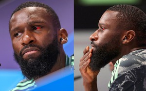 Rudiger để lộ mắt đỏ khủng khiếp với 20 mũi khâu sau chấn thương