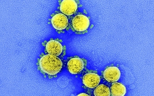 WHO bổ sung hai biến thể mới của Omicron vào danh sách cần theo dõi