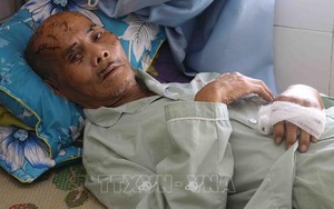 Phú Yên: Điều tra vụ cụ ông bị người thân hành hung phải nhập viện