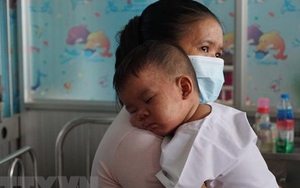 Xuất hiện ca viêm não - màng não do biến chứng của sởi