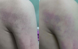 Vụ học sinh lớp 1 bị giáo viên đánh ở Hà Nội: Gia đình yêu cầu giáo viên viết cam kết