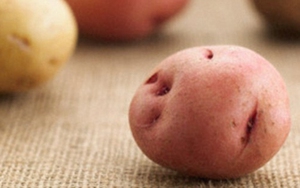 Cô gái 22 tuổi nhập viện vì dùng khoai tây tránh thai