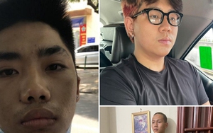 Bắt đối tượng thứ 4 trong nhóm cướp xe máy nữ công nhân vệ sinh môi trường