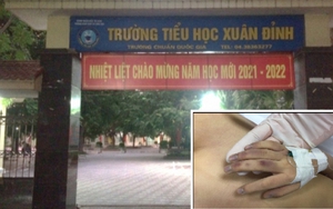 Vụ cháu 6 tuổi ở Hà Nội chết nghi do bị bạo hành: Khởi tố, bắt tạm giam người bố