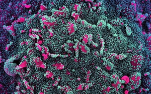 Dòng phụ mới BA.4 và BA.5 của biến thể Omicron có khả năng lẩn trốn hệ miễn dịch