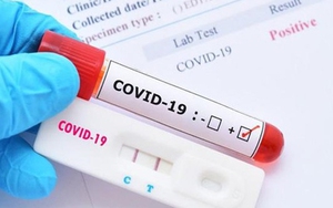 Phát triển bộ xét nghiệm Covid-19 mới có mức độ chính xác tương đương phương pháp PCR