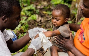 Peru giải mã thành công trình tự gene virus đậu mùa khỉ