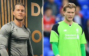 Loris Karius gây sốc với thể hình như... 'Kẻ hủy diệt'