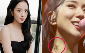 Cổ Jisoo BlackPink lại sưng vì hạch bạch huyết: Căn bệnh phổ biến nhưng tiềm ẩn nguy cơ chuyển biến thành ung thư