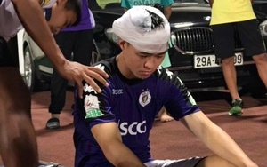 Duy Mạnh không bị chấn thương nặng vùng đầu