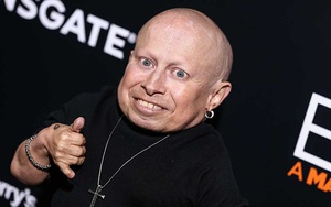 Sao tí hon đóng yêu tinh trong ‘Harry Potter’ Verne Troyer qua đời