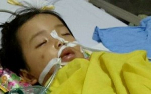 Làm rõ vụ trẻ 20 tháng tuổi bị chấn thương sọ não ở trường mầm non