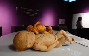 Bộ VH,TT&DL yêu cầu báo cáo về triển lãm 'Sự bí ẩn đặc biệt của cơ thể người'