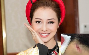 Hoa hậu Jennifer Phạm ngã trên sân khấu, phải đi cấp cứu