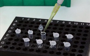 Quảng Bình kích hoạt toàn bộ hệ thống phòng, chống dịch COVID-19 sau ca tái dương tính