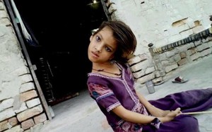 Lặng người trước bé gái bị lệch cổ 90 độ như phim kinh dị