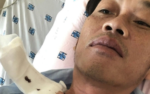 Hoài Linh bị ung thư tuyến giáp, phải xạ trị 2 lần