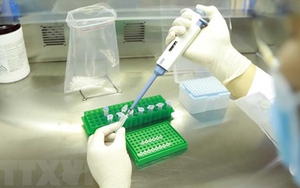 Kết luận thanh tra việc mua sắm trang thiết bị, vật tư y tế tại CDC Bình Thuận