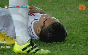 Cảm phục trước hình ảnh Quang Hải đổ máu vì chiến thắng U23 Việt Nam