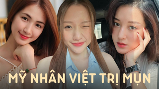 Mỹ nhân Vbiz từng 'khốn khổ' vì mặt mụn, giờ lấy lại phong độ đỉnh cao nhờ 'đúng thầy đúng thuốc' 