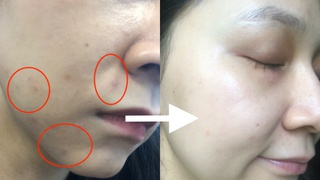 Dùng thử dầu dưỡng da giá 150k mà beauty blogger Trinh Phạm gợi ý: Lên da mịn mướt, vết thâm mờ hẳn sau vài ngày