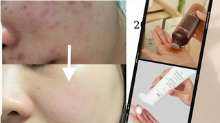 Tuân thủ 3 tips skincare, cô nàng giữ làn da láng mịn không mụn suốt 4 năm