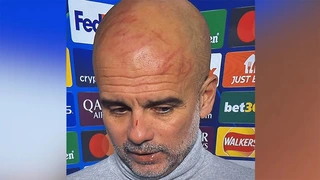 Pep Guardiola lộ gương mặt bầm tím trong buổi họp báo sau trận Man City vs Feyenoord