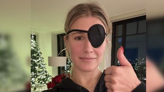 Hơn 3000 ca chấn thương mắt vì chơi pickleball, bác sĩ Mỹ khuyến cáo dùng kính bảo hộ vì quả bóng bay quá nhanh