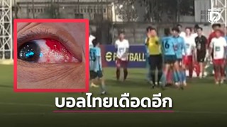 Tức giận vì bị đuổi, cầu thủ Thái Lan đấm trọng tài, hành hung đối phương suýt mù mắt
