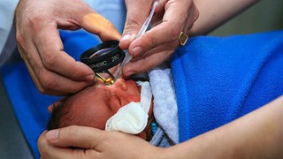 Bệnh lý võng mạc trẻ sinh non