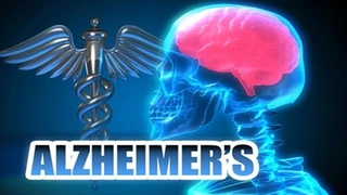 Phát hiện cơ chế giúp não tự làm sạch, mở ra hy vọng chữa Alzheimer