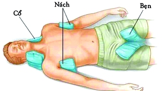 Cấp cứu thành công bệnh nhân hôn mê do say nắng