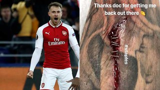 Aaron Ramsey phải vá chân bằng... ghim khi ghi bàn trước CSKA Moskva