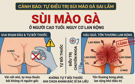 Sùi mào gà ở người cao tuổi: Xấu hổ tự điều trị hay đối mặt nguy cơ lan rộng khó lường?